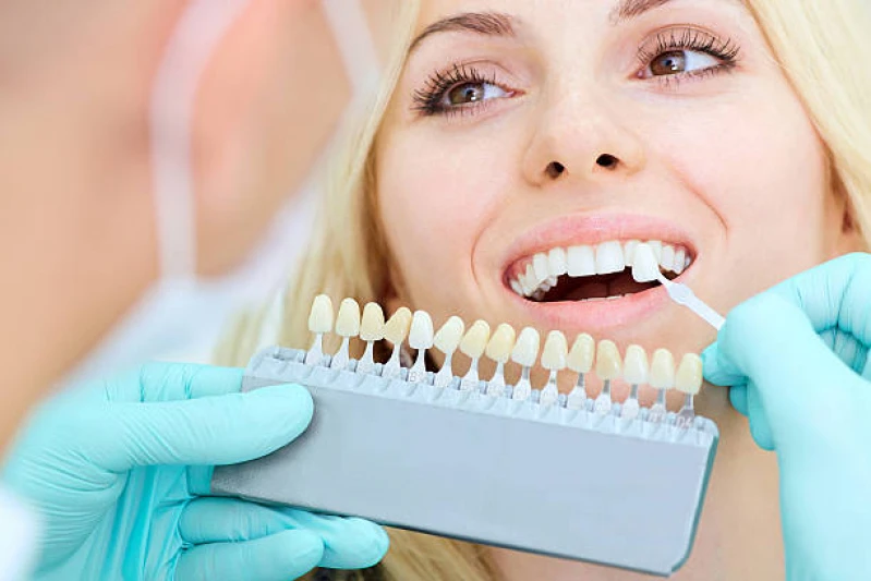 implante de resina dental