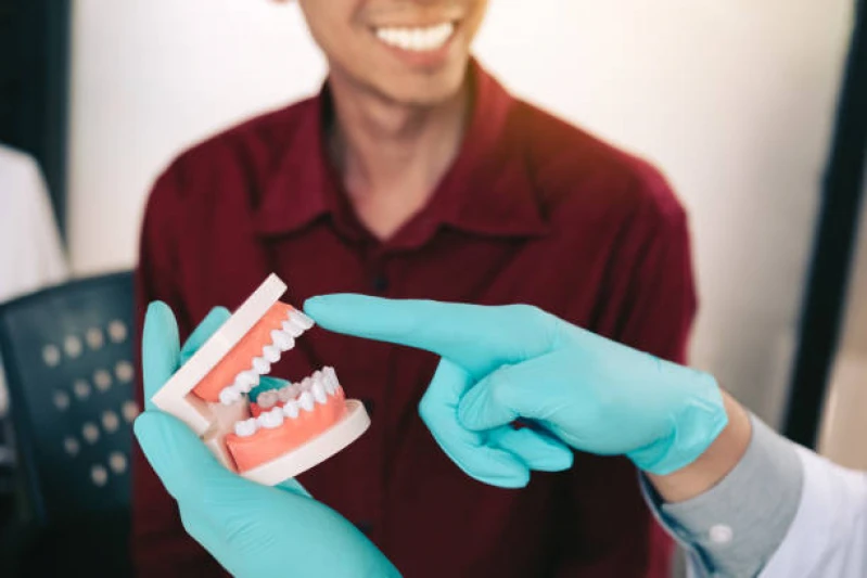 implante de todos os dentes