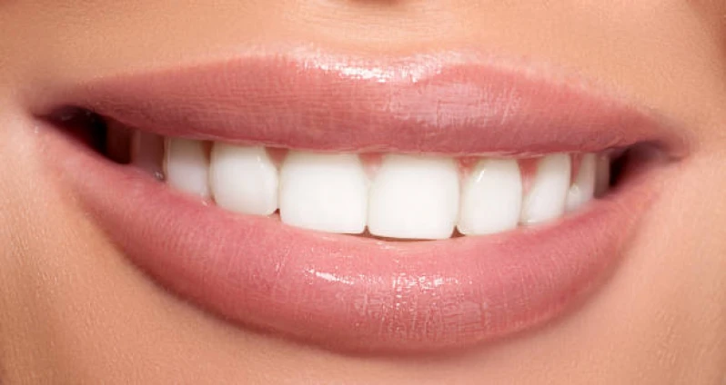 lente de contato em dente