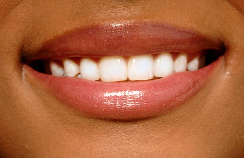 lente de contato para o dente